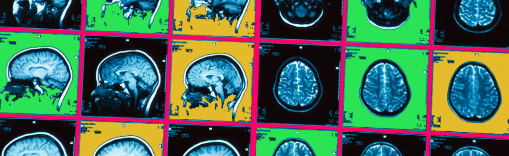 brain scan 2 colored